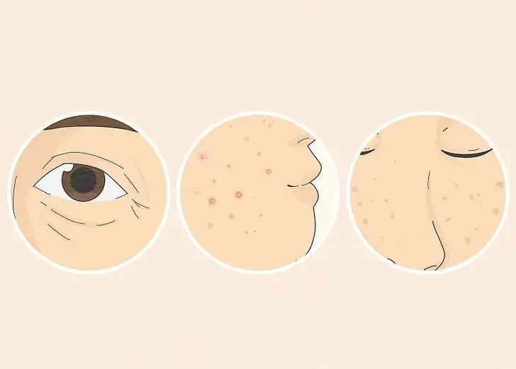 چگونه ضدآفتاب مناسب برای پوست چرب خود را انتخاب کنیم؟